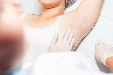 Armpit Lumps Causes Symptoms Treatment Home Care