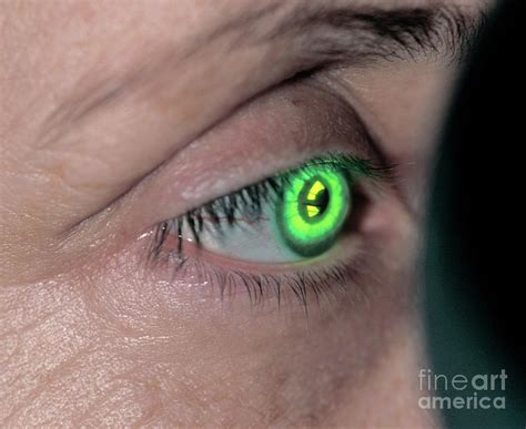 Eye Examination Photograph By Pascal Goetgheluck Science Photo Library Fine Art America