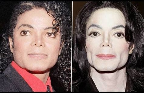 Michael Jacksons Fucked Up Face