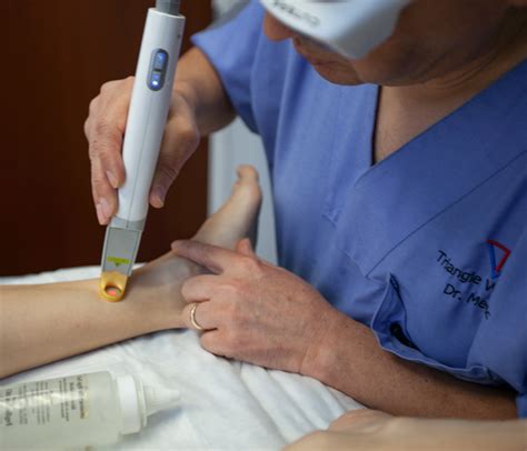 Sclerotherapy And Laser Treatments Triangle Vein Clinic Cary Nc
