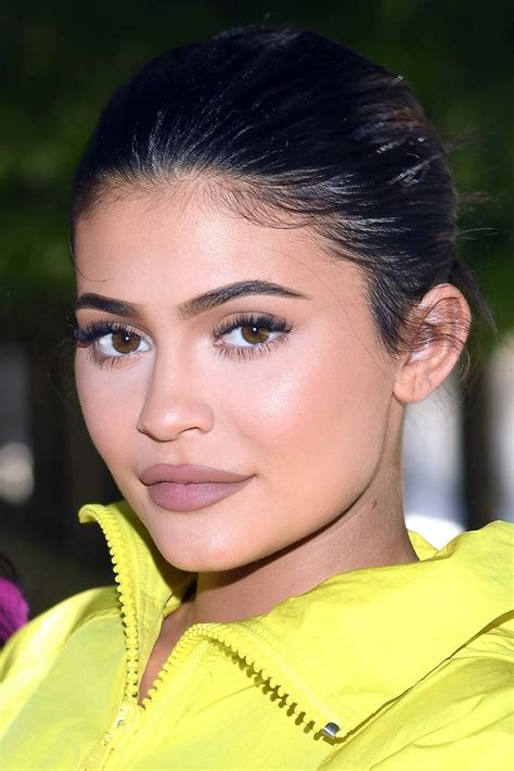 kylie jenner removed her lip fillers