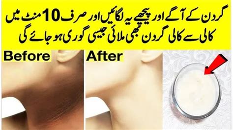 Neck Whitening Special Cream At Home Neck Care Tips In Urdu By