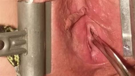 Female Urethral Stretching Spread Probed Peehole With Metal Sounds Video Porno Gratis Youporn