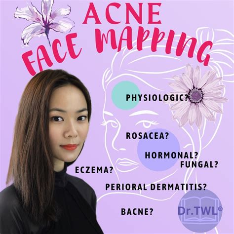 Complete Acne Guide Drtwl Dermaceuticals Singapore Dermatologist