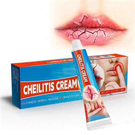 20g Cheilitis Cream For Dry Chapped Cracked Peeling And Bleeding Lips