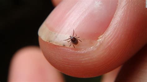 What You Need To Know About Ticks And Lyme Disease To Stay Safe Cnn