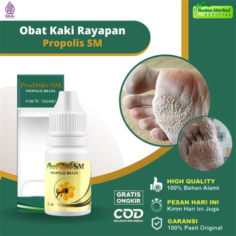 Jual Obat Kaki Rayapan Pitted Keratolisis Obat Telapak Kaki Bau Bolong