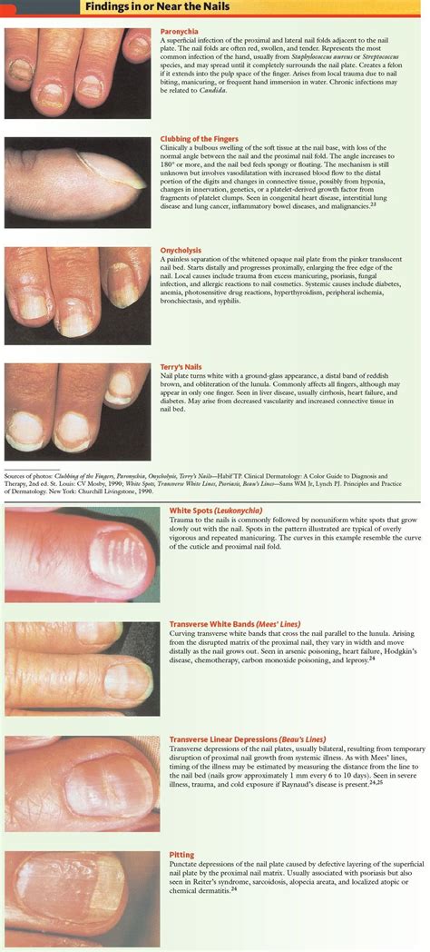 Nail Pathologies Findings In Or Near Nails Paronychia A Superficial