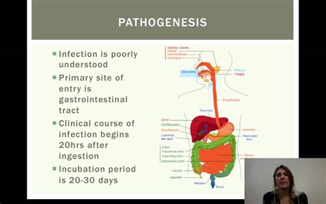 Listeria Disease Report Presentation Youtube