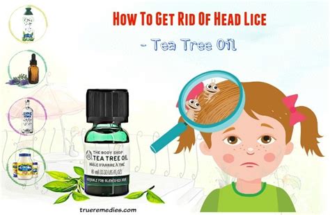 29 Tips How To Get Rid Of Head Lice Fast Eggs Fast At Home