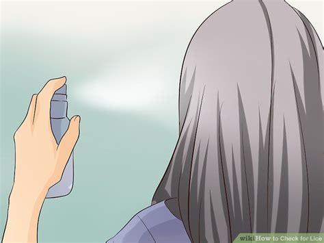 Check spelling or type a new query. How to Check for Lice (with Pictures) - wikiHow