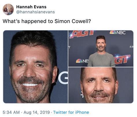 what happened simon cowell s face know your meme