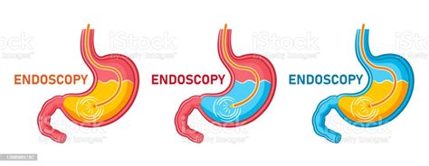 Endoscopy Stomach Gastroscopy Icon Set Gastroenterology Endoscope