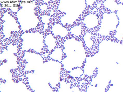 Listeria Monocytogenes Colony Morphology Listeriosis An Update