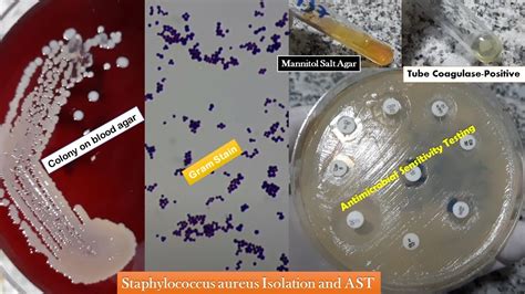 Staphylococcus Aureus Golden Yellow Colonies Gram Stain Coagulase