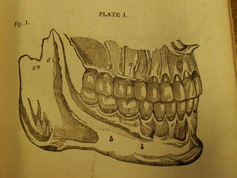 John Hunter Plates American Journal Of Dental Science Vo