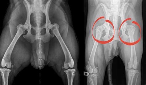Get offers and discounts on hip replacement surgery cost in hyderabad. Average Cost Of Hip Replacement With Insurance - How Much Does A Hip Replacement Cost 95 459 Or ...