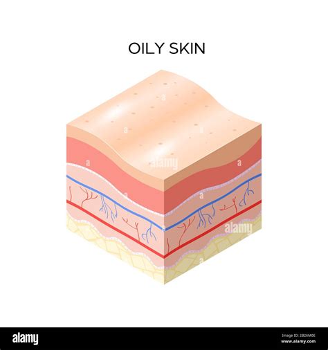 Oily Skin Cross Section Of Human Skin Layers Structure Skincare Medical
