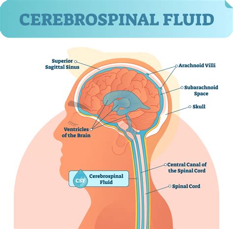 Cerebrospinal Fluid Leak Dr Candice Colby Scott MD