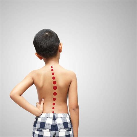 How To Check For Scoliosis Yourself Home Screening Guidelines