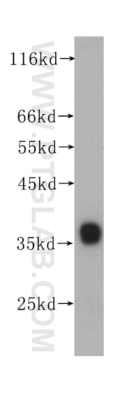 Il8cxcl8 Antibody 60141 1 Ig Proteintech