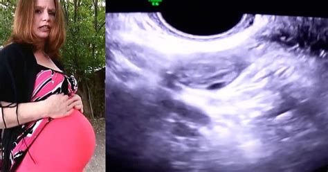 Woman Insists She Has Been Pregnant For 3 Years And 7 Months Despite