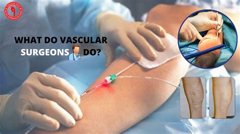 What Do Vascular Surgeons Do