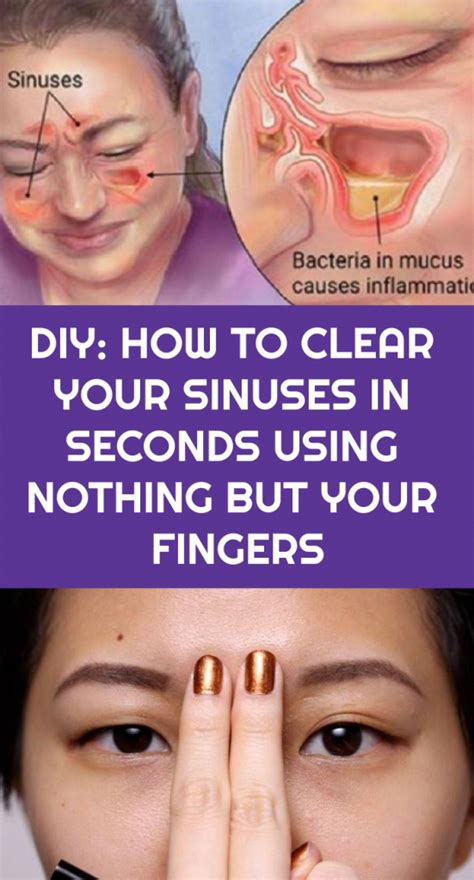 Reliable Strategies For Sinus You Can Use Starting Today In 2020 Sinusitis How To Clear