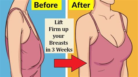 How To Prevent Sagging Breasts Naturally In Weeks