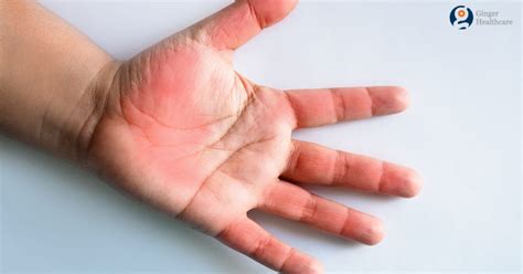 Carpal Tunnel Syndrome Symptoms Causes Risk Factors Diagnosis