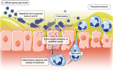 The Pathogenesis Of Clostridioides Difficile C Difficile Spores