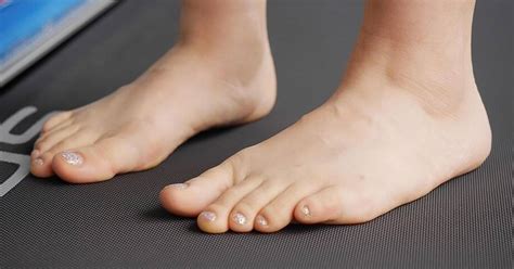 Foot Specialist Clinic In Singapore For Curly Toe Syndrome