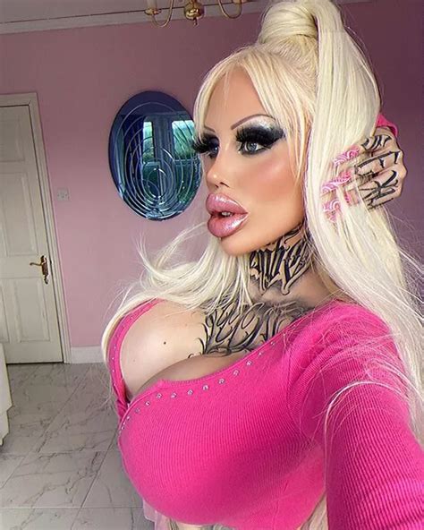 Plastic Surgery Fan Posts Snap Taken Before Dramatic Bimbo