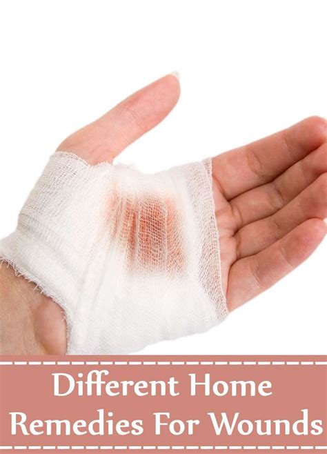 13 Different Home Remedies For Wounds Search Home Remedy