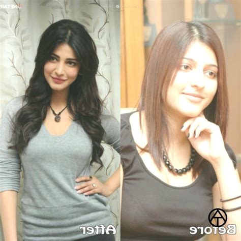 Top Bollywood Plastic Surgery Before And After Shruti Hassan Nose Job
