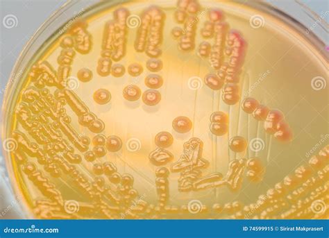 Bacterial Colonies Culture On Macconkey Agar Media Stock Image Image