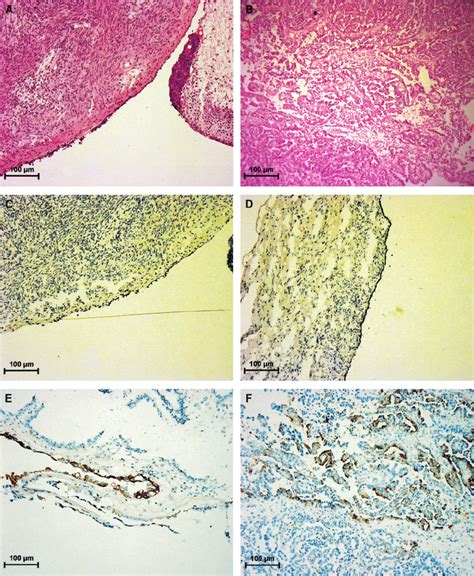 Haematoxylin And Eosin Staining Of A Normal Ovary And B Grade