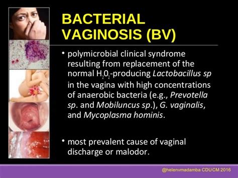 Infections Of The Genital Tract Part Ii