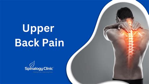 Upper Back Pain Causes Symptoms And Relief Strategies Best Back