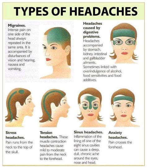 This Is Good To Know Headache Types Migraines Remedies Tension