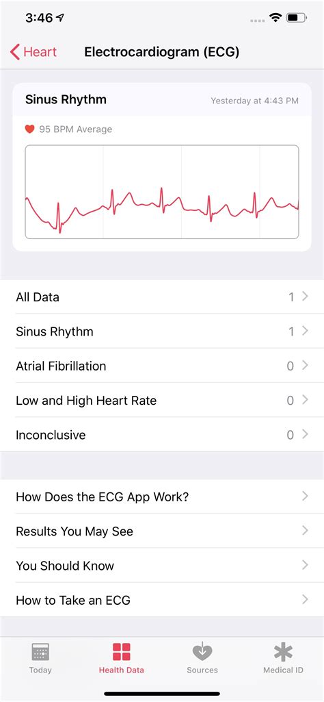 How To Take An Ecg With Your Apple Watch Digital Trends