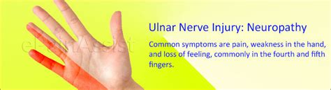 Ulnar Nerve Pain Symptoms