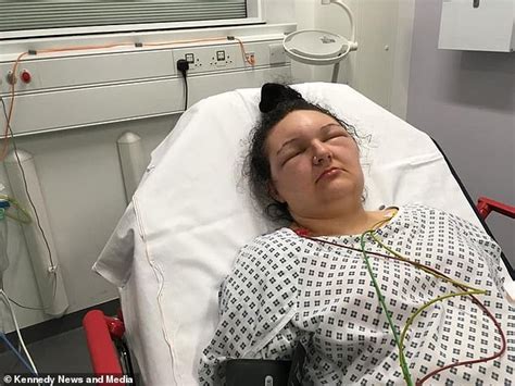 Try calendula, marigold, rosehip, and hibiscus to deepen the shade. Teenager, 18, rushed to hospital after allergic reaction ...