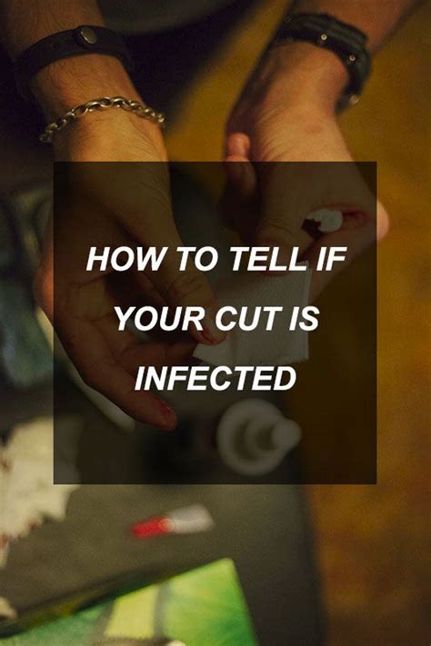 Learn how to tell if your cut is infected, and ways to help wounds heal and minimize scarring. Pin on Survivalists & Preppers