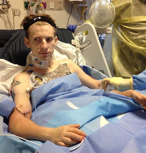 Quadruple Amputee Vet Gets Double Arm Transplant Photo 18 Cbs News