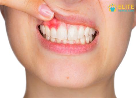 common causes of sensitive teeth elite dental care tracy elite dental care