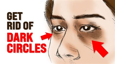 What Causes Dark Circles Under Eyes Dr Berg Youtube