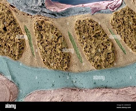 Foetal Spinal Column Coloured Scanning Electron Micrograph Sem Of