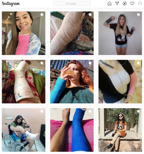 Instagram Cast Honey Free Website Casts Braces Crutches Cnews