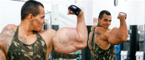 Brazilian Bodybuilder Claims Synthetic Material Brought Huge Muscles But Also Medical Danger